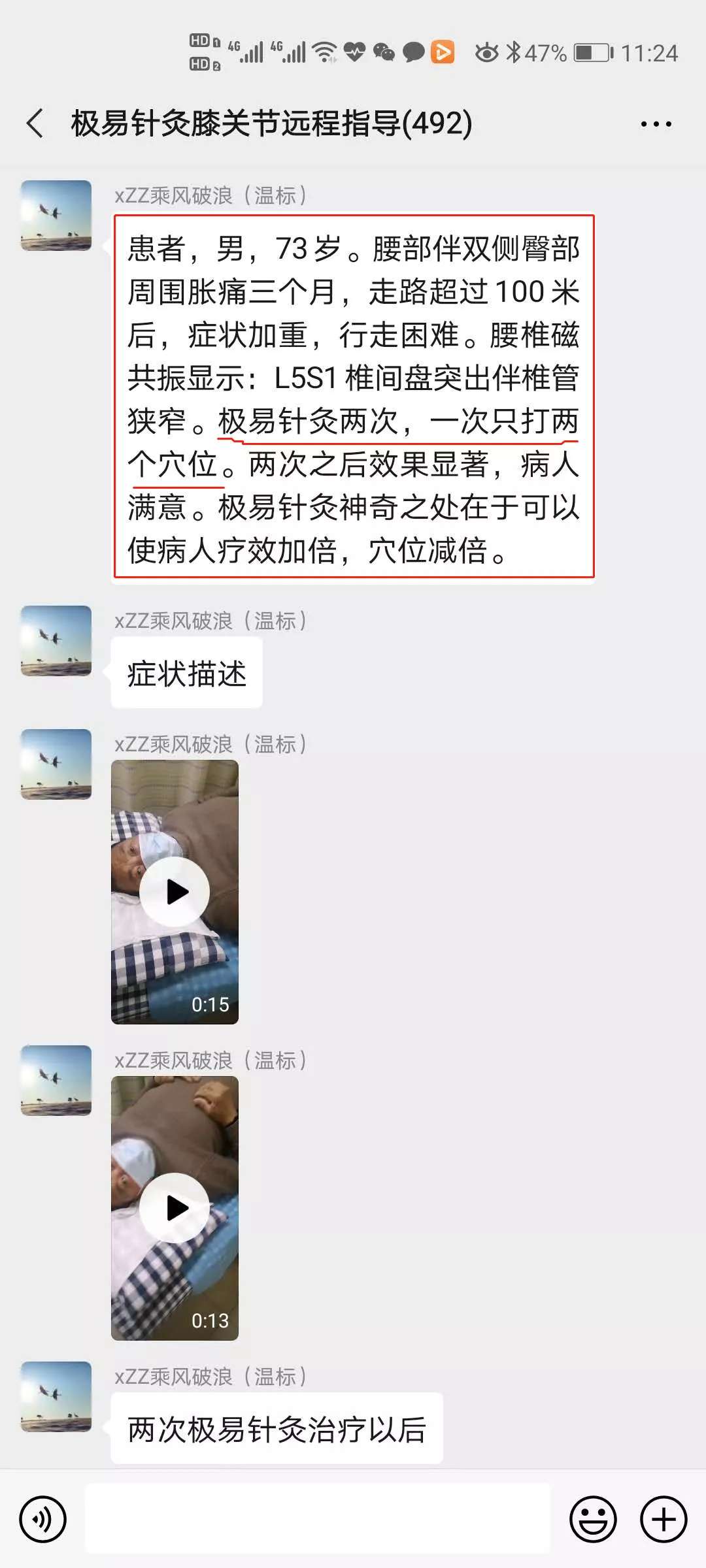 极易针灸治疗腰扭伤