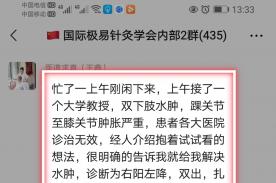 极易针灸治疗水肿，膝关节肿胀