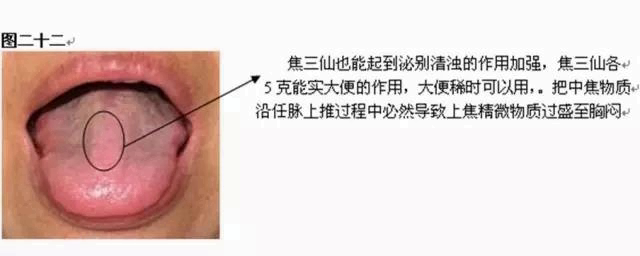 人体空间医学