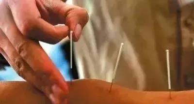 经络穴位、针灸歌诀、12急症处方