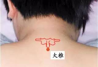急救常识你知道多少？ 教你十大针灸穴位救急法